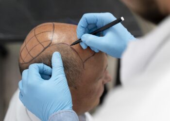 Reliable Hair Transplant in Turkey 2022