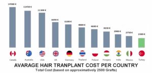 Hair Transplant Cost In Turkey
