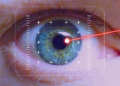 Laser Eye Surgery in Istanbul