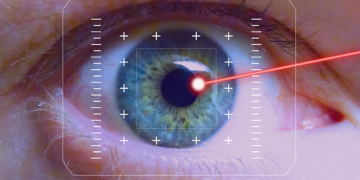 Laser Eye Surgery in Istanbul
