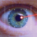 Laser Eye Surgery in Istanbul