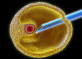 Successful Fertility Treatment in Turkey 2022