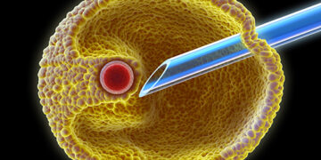 Successful Fertility Treatment in Turkey 2022