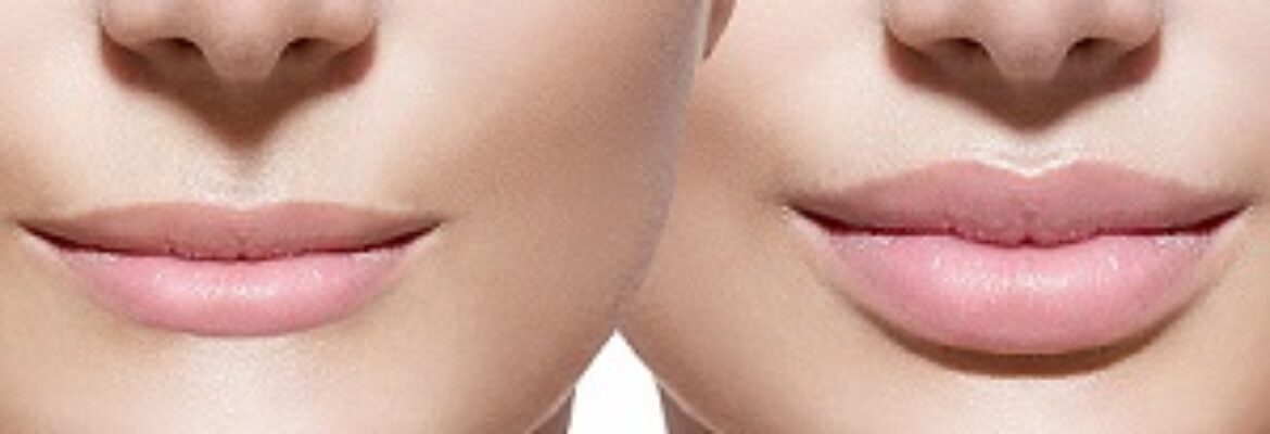 is it safe to get plastic surgery in Turkey