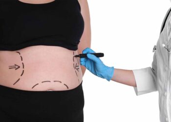 Effective Weight Loss Surgery in Turkey 2022