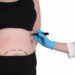 Effective Weight Loss Surgery in Turkey 2022