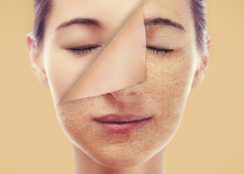 Skin Treatment In Turkey 2022