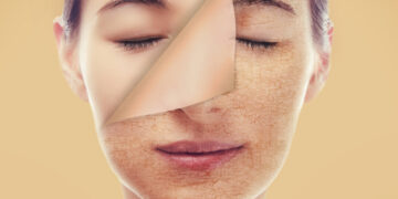 Skin Treatment In Turkey 2022