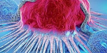 Cancer treatment in Turkey