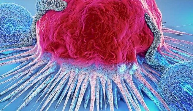 Cancer treatment in Turkey