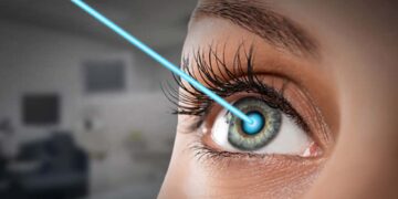 Lasik Eye Surgery Cost in Istanbul