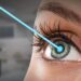 Lasik Eye Surgery Cost in Istanbul