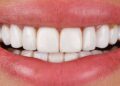 Dental treatment in Turkiye