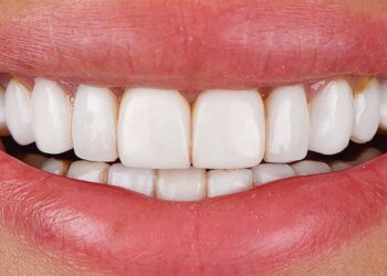 Dental treatment in Turkiye