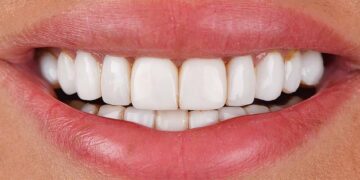 Dental treatment in Turkiye