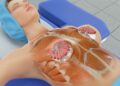 Breast Surgery in Istanbul