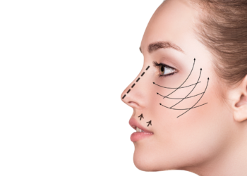 Facelift in Turkiye 2022