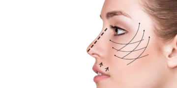 Facelift in Turkiye 2022