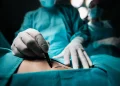 General surgery in Turkiye