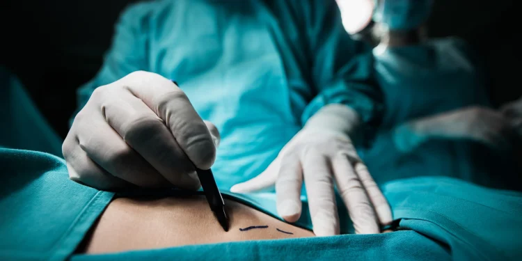 General surgery in Turkiye