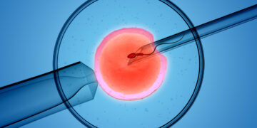 IVF Treatment in Turkiye