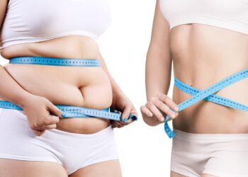 liposuction in Turkiye