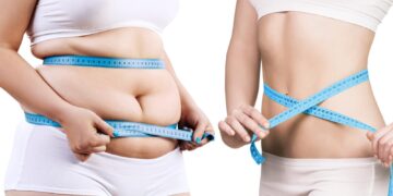 liposuction in Turkiye