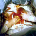 surgery in Turkiye