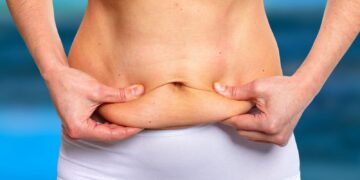Tummy tuck in Turkiye
